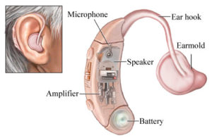 Hearing Misfortune